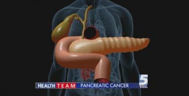 pancreaticcancer.jpg